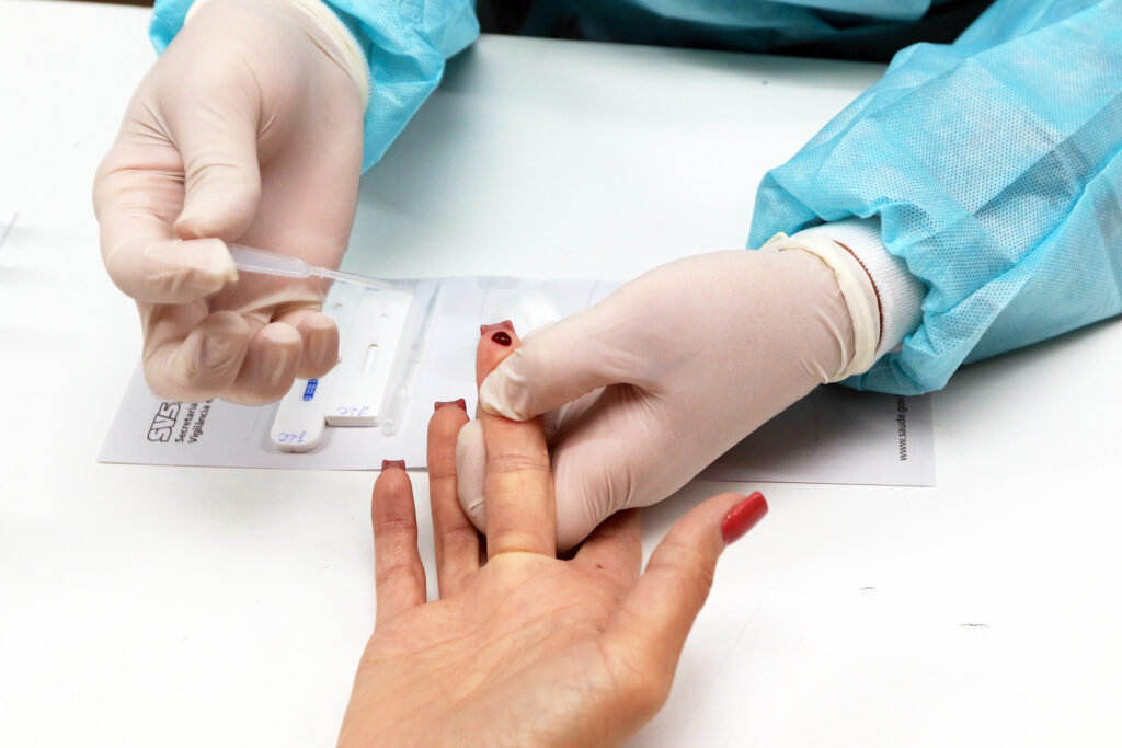 Luta contra o HIV: SCS recebe testagem rápida na segunda-feira