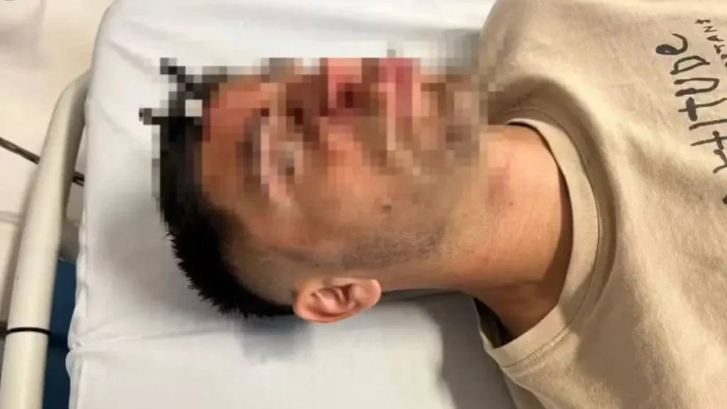 chave cravada na testa