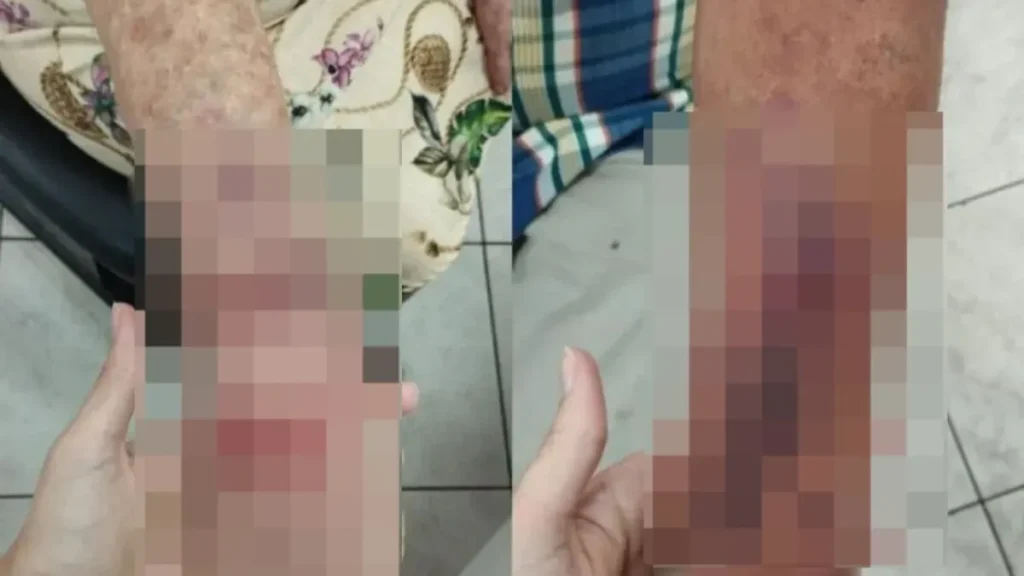 Idosa é agredida em briga em condomínio de Aparecida