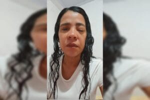 Mulher com câncer de pele relata dificuldades no tratamento pelo SUS
