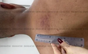 Exame de corpo de delito aponta lesões em feminicida que matou cabo