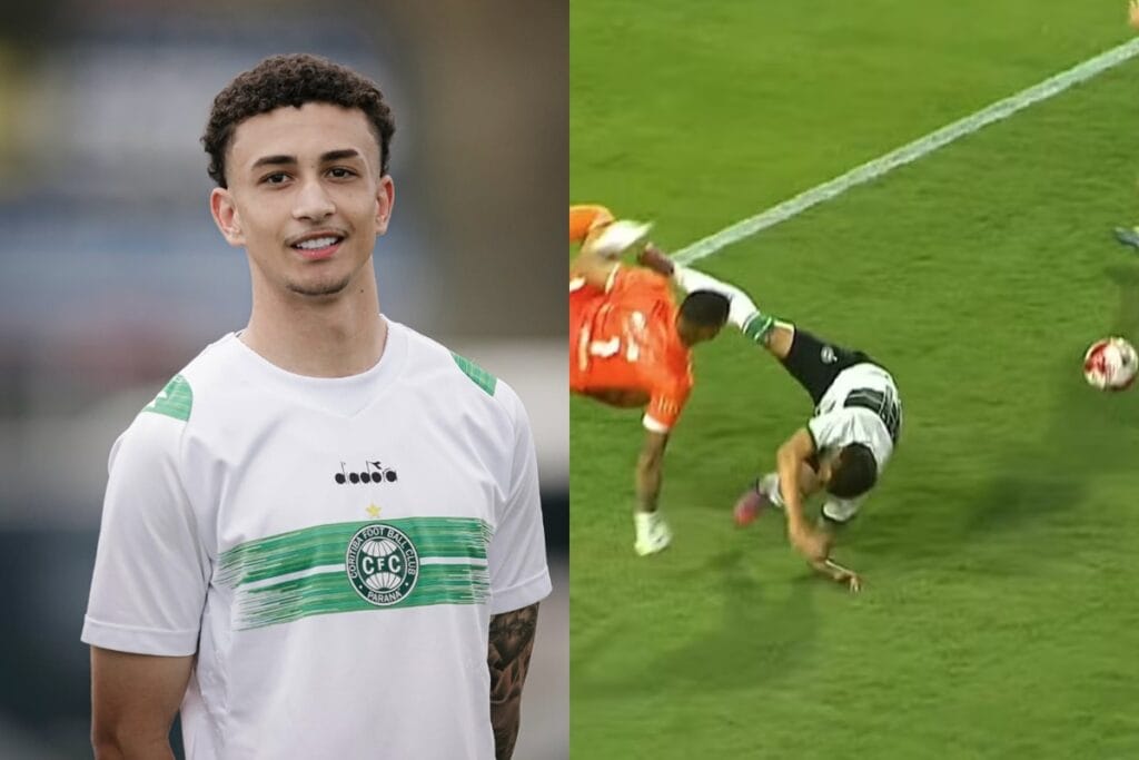 Atacante do Coritiba quebra o braço em jogo de estreia pelo Paranaense