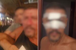 Empresário é agredido por segurança de quiosque no litoral de SP