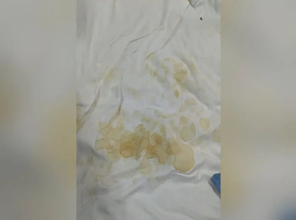 Falta de lençóis obriga pacientes a permanecerem em leitos sujos no Hugol, em Goiânia