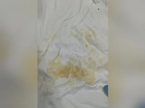 Falta de lençóis obriga pacientes a permanecerem em leitos sujos no Hugol, em Goiânia