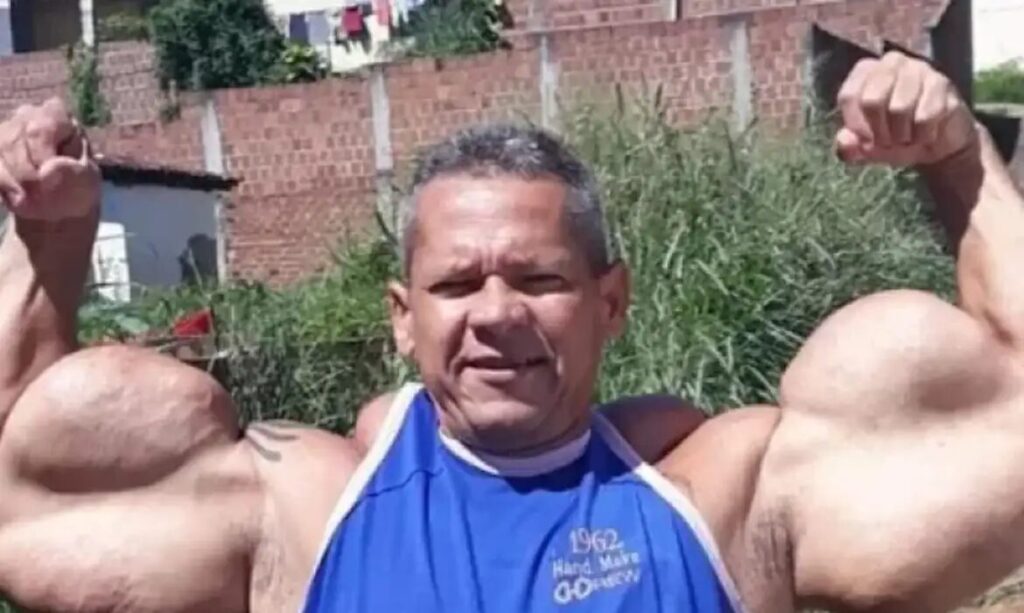 Popeye Brasileiro morre aos 55 anos