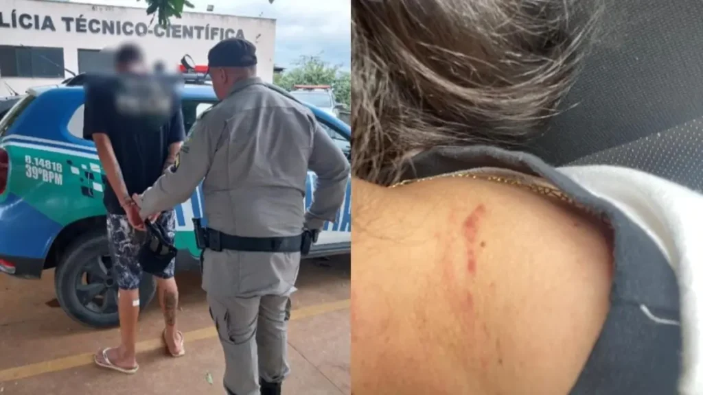 Motorista ficou com marcas no pescoço devido a agressão - (Foto: divulgação/PM)