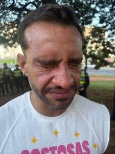 Bloco Rebu repudia ação policial após deputado Fábio Felix ser atingido por spray de pimenta