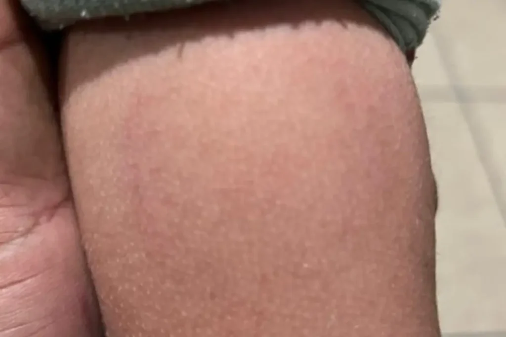 Mãe denuncia maus-tratos após filho de 3 anos ser mordido por diretora de berçário em Goiânia