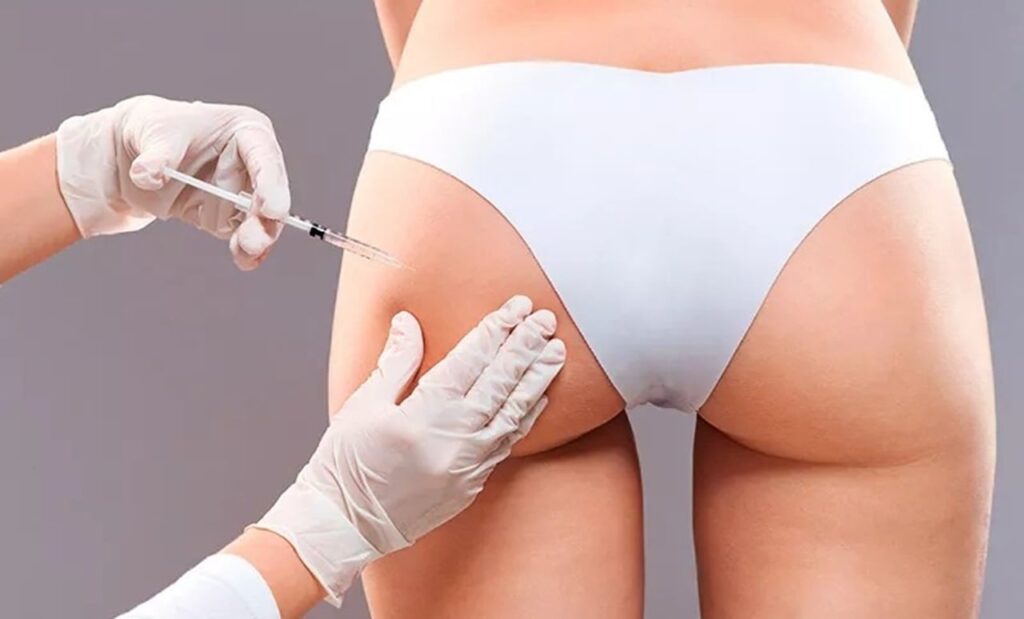 Sociedade Brasileira de Dermatologia defende suspensão do PMMA em procedimentos estéticos