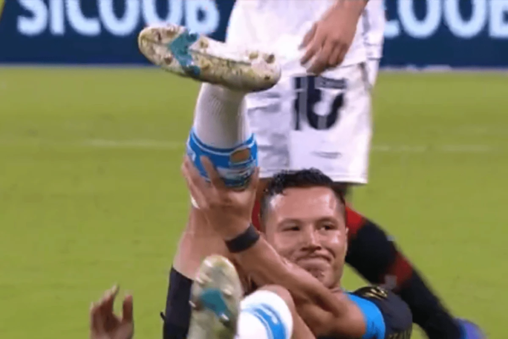 Jogador do Grêmio deixa campo de ambulância após lesão; confira