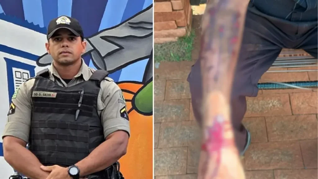 Imagem mostra policial envolvido na ação e braço do idoso machucado