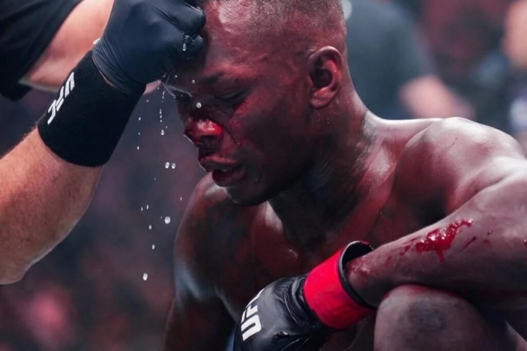 Adesanya bate martelo em decisão sobre aposentadoria após derrota