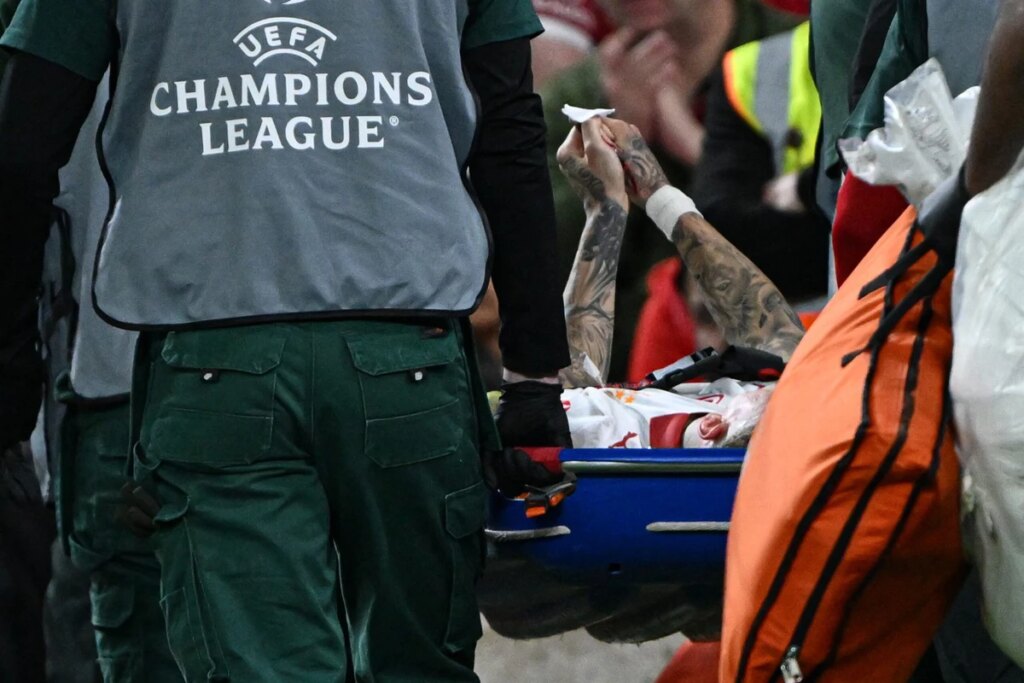 Uefa vai analisar painéis de LED após atleta ter dedo quase decepado