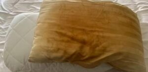 O que deixa o travesseiro amarelado mesmo com fronha sempre limpa