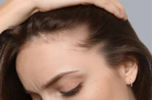 ICF Goiás busca voluntários para tratamento