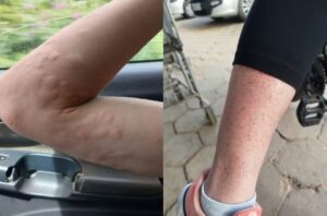 Infestação de maruim obriga moradores a viver com portas fechadas em cidade de SC