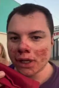 Promotor de festa universitária entra em coma após agressão atribuída a alunos do Mackenzie