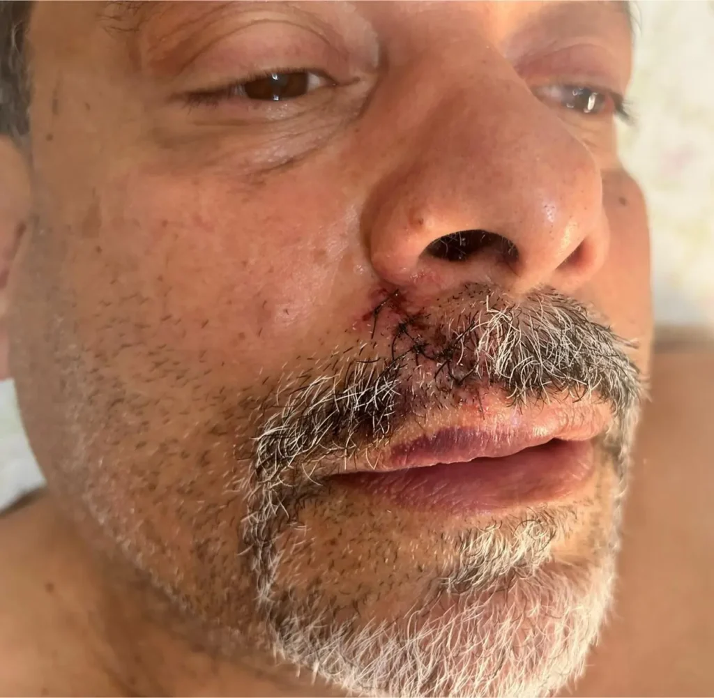 Acusado de racismo, ex-presidente do Vila fala de agressão, gesto e afirma: "denúncia caluniosa"