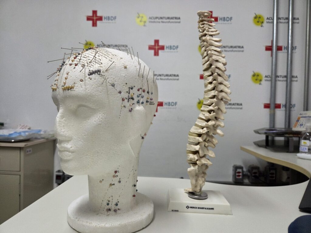 Hospital de Base aprimora técnicas de acupuntura médica para tratamento da dor