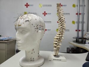 Hospital de Base aprimora técnicas de acupuntura médica para tratamento da dor