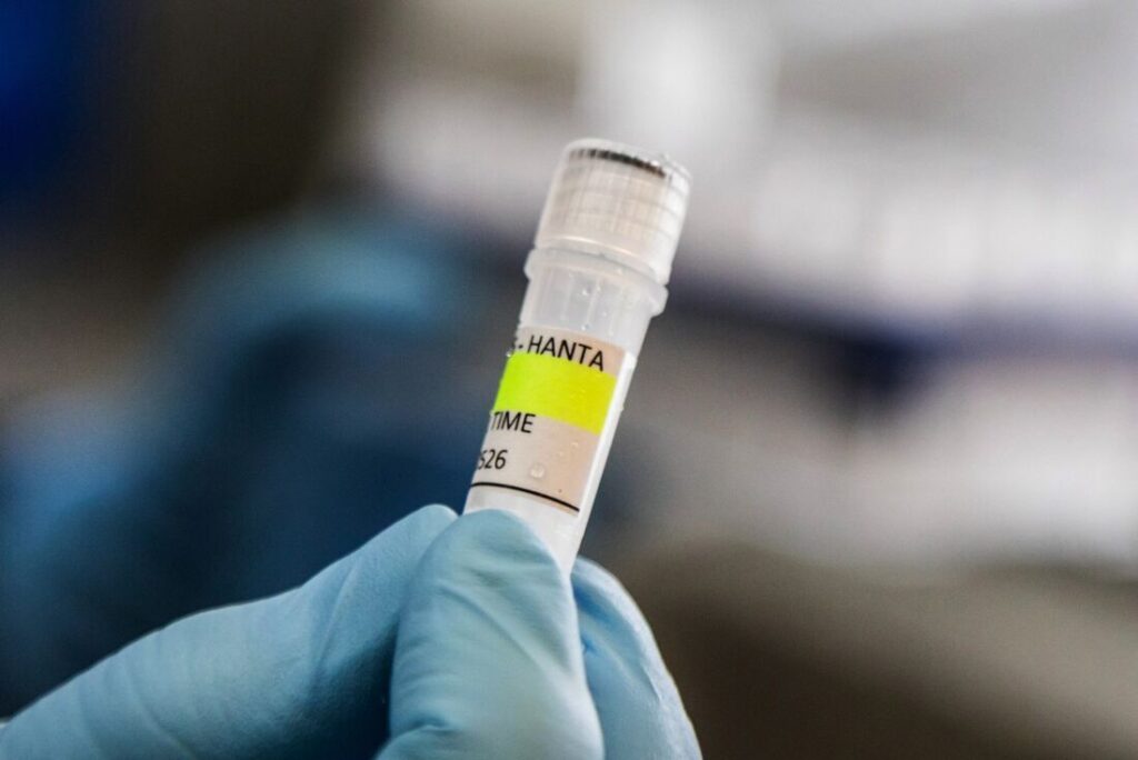 Nada indica que a cepa Andes do hantavírus tenha sofrido mutação, avalia agência sanitária da UE