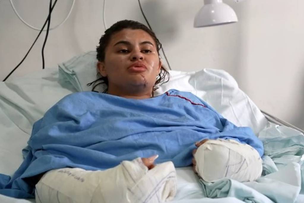 ‘Me fiz de morta’, diz estudante que teve as mãos amputadas em ataque com foice no Ceará