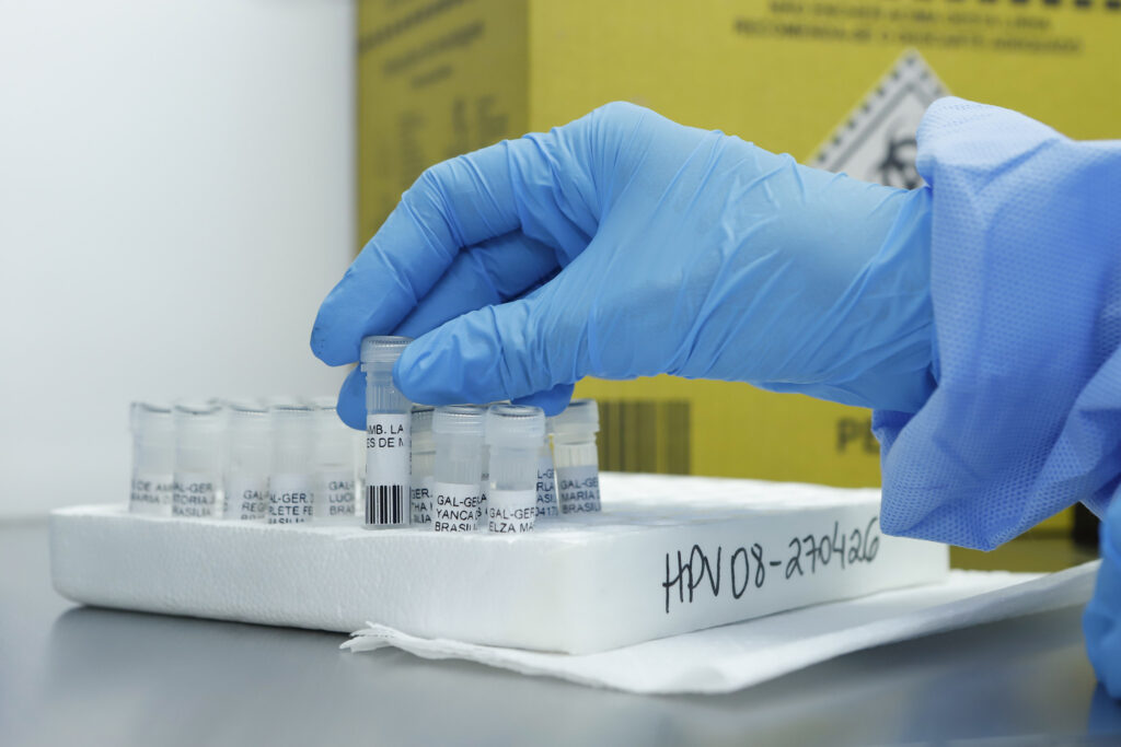 DF pioneiro em teste de DNA-HPV para rastreio de câncer de colo do útero