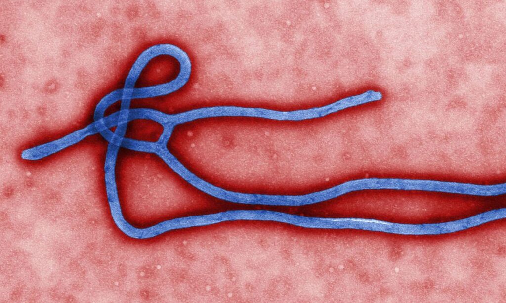 Rio Grande do Sul investiga caso suspeito de ebola