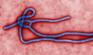 Rio Grande do Sul investiga caso suspeito de ebola