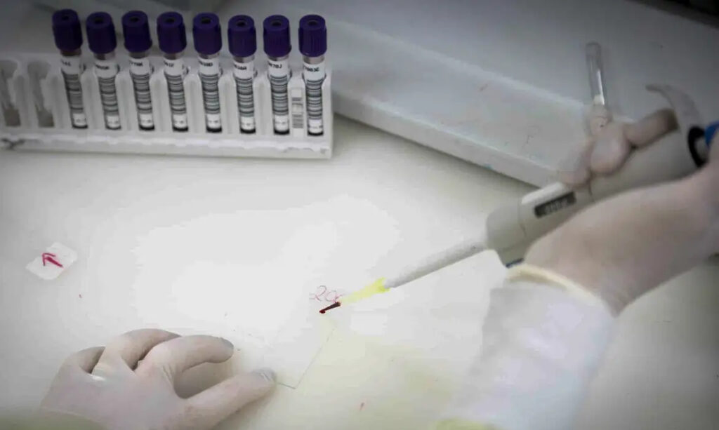 São Paulo investiga novo caso suspeito de ebola
