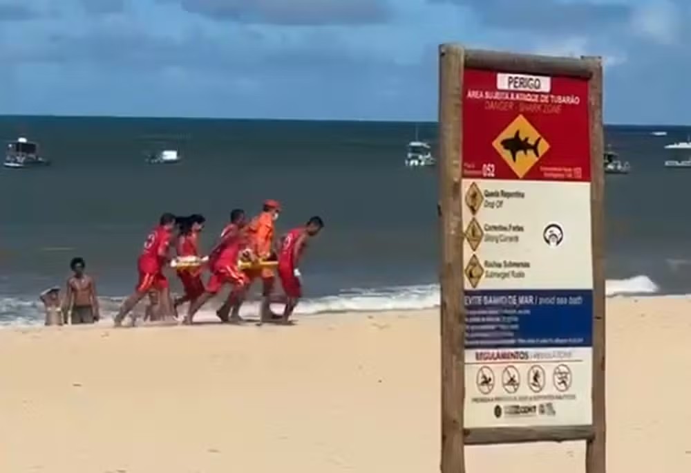 Menino mordido por tubarão em PE teve perna amputada e está em estado grave