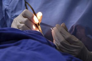 Vigilância Sanitária do Distrito Federal atinge número recorde de interdições feitas em clínicas de estética