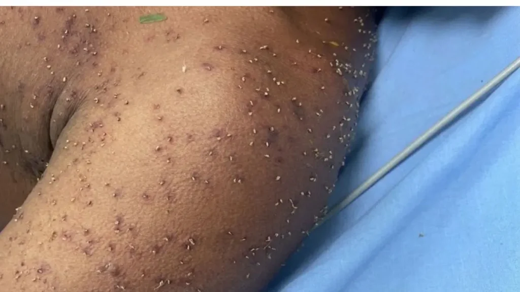 Homem é atacado por enxame de abelhas em Itapuranga