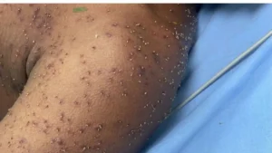 Homem é atacado por enxame de abelhas em Itapuranga