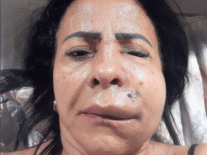 rita apos procedimento estetico realizado em 2023 1715892535709 v2 450x337