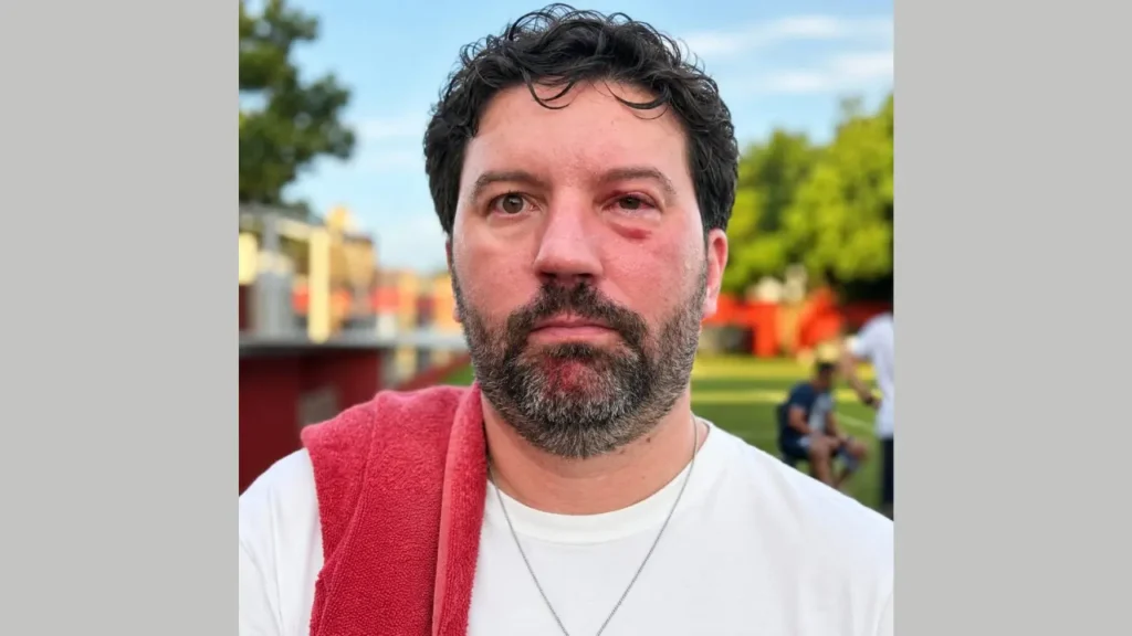 Jornalista é agredido por jogador do São Luís na 2° Divisão Goiana